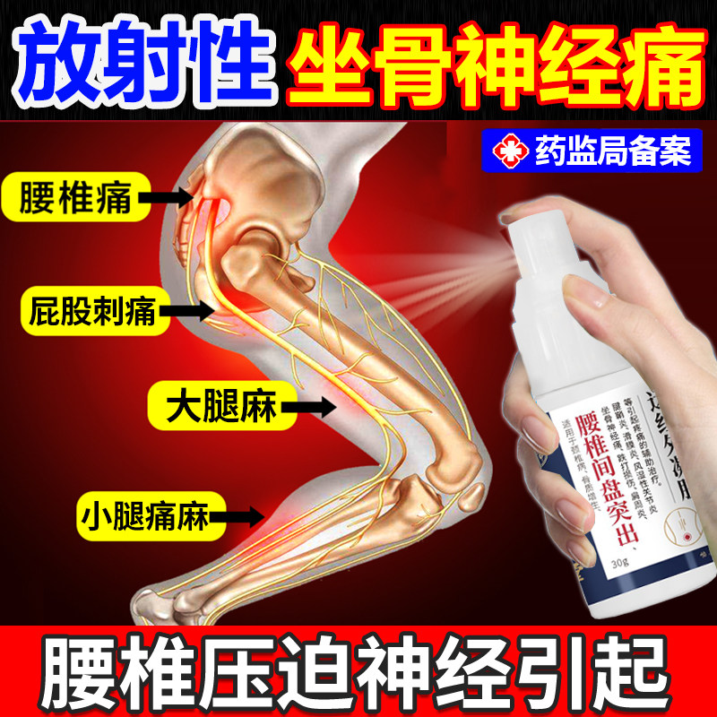 坐骨神经痛腿麻屁股疼药监备案膏贴腰椎压迫通络止痛神器喷雾剂xj