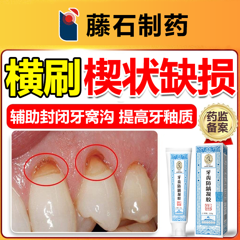 牙齿楔状缺损修补牙膏牙周炎口腔牙龈缩敏感酸痛修护龈复医用wg