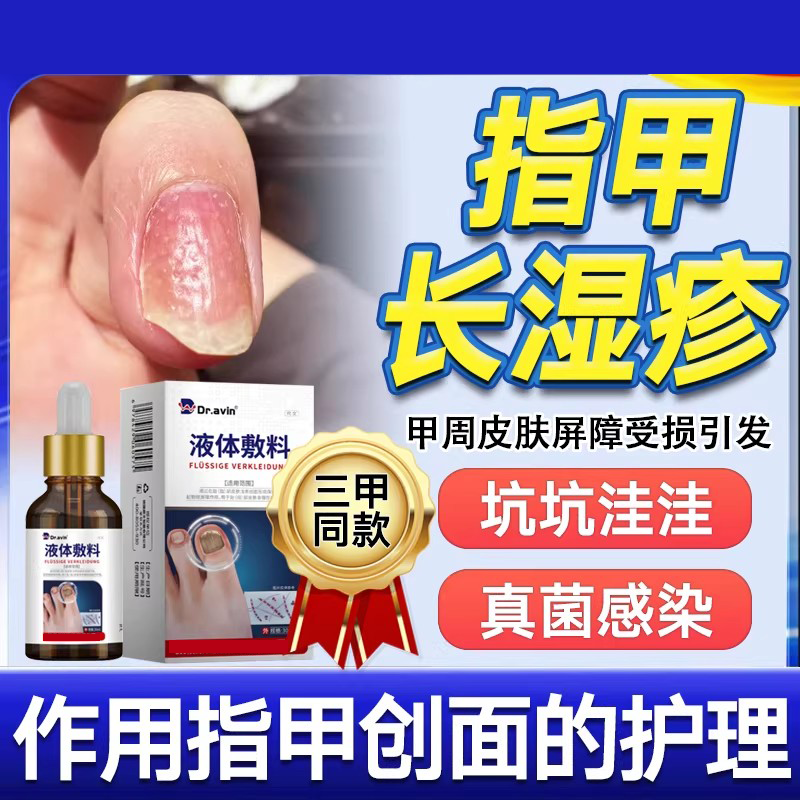 手指甲坑坑洼洼真菌感染湿银屑病甲疹指甲凹凸凹陷不平敷液xj