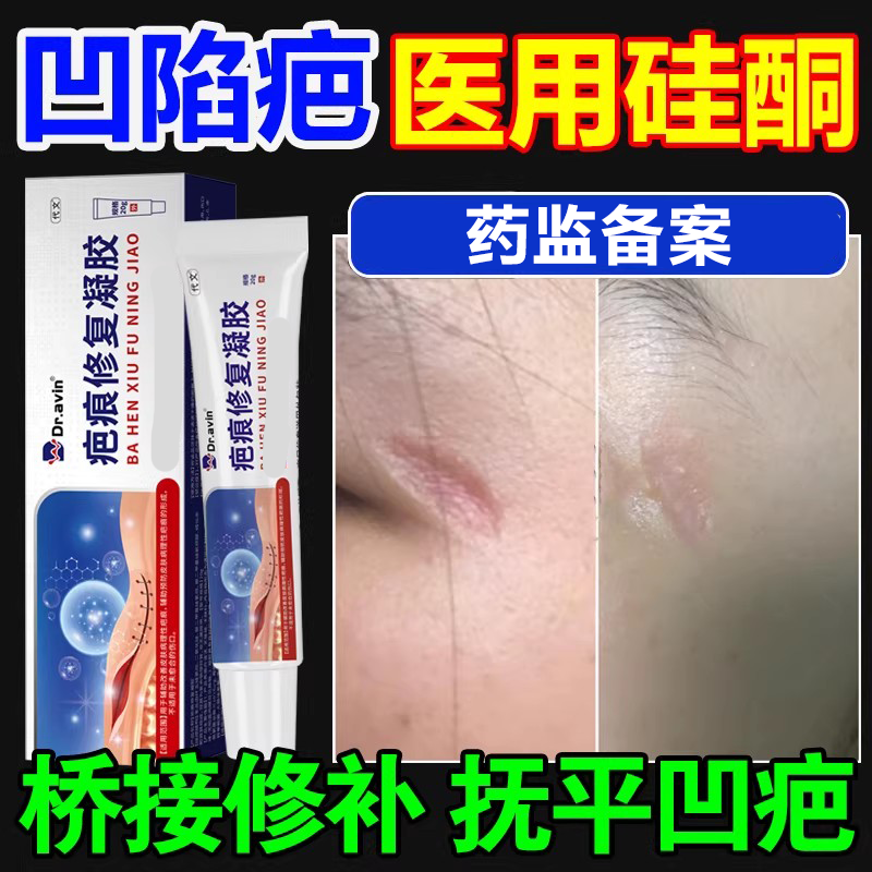 凹陷性疤痕生长因子祛疤膏遮盖神器去贴修陈旧面部填充复除疤膏xj