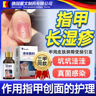 手指甲坑坑洼洼真菌感染湿银屑病甲疹指甲凹凸凹陷不平敷液hy