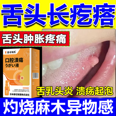 舌头两边长肉疙瘩舌乳头炎