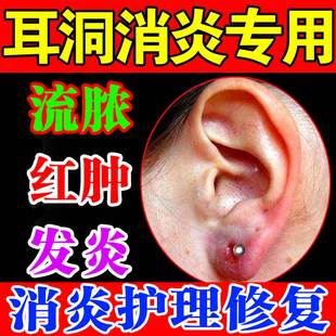 极速耳洞a液耳洞养护清洁线去异味耳洞发炎流脓耳洞护理液