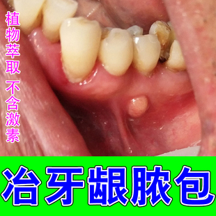 冶牙龈脓包牙肉红肿上火修护牙龈上火鼓包脓肿出血专用修复药乳膏