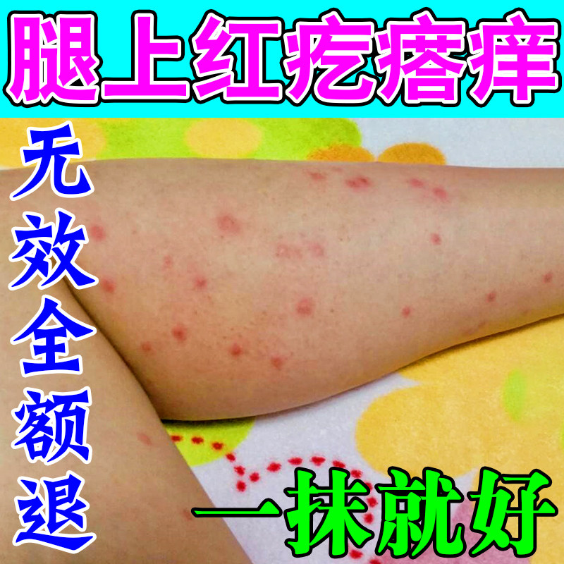 身上皮肤痒长小红点腿部丘疹身上起红疙瘩痒过敏痒治疗皮肤痒的药