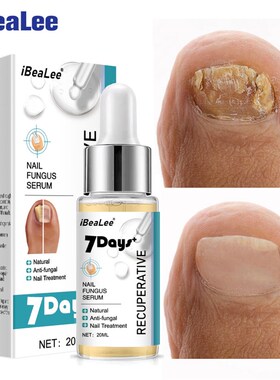 极速iBeaLeef 7DAYS Repair Nail Fungus Treatments Essence Foo