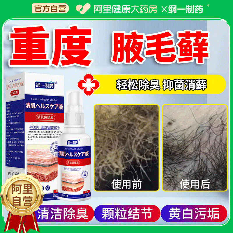 腋毛癣白色附着物胳肢窝出汗腋毛污垢红肿瘙痒异味去狐臭清洗液男