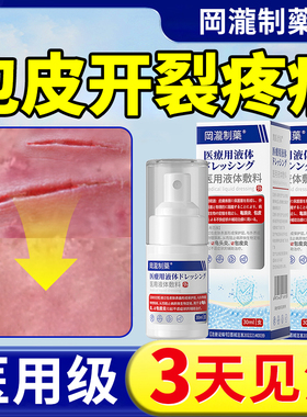 包皮开裂专用龟头炎口子疼痛发炎红肿包真菌感染干裂破皮裂口什么