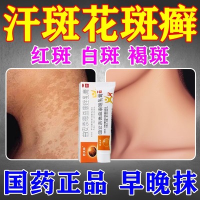 【舒夫林】曲安奈德益康唑乳膏0.1%1%*15g*1支/盒