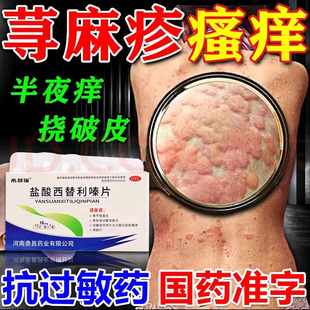 盐酸西替利嗪片旗舰店治疗寻荨麻疹过敏药内服止痒皮肤瘙痒鼻炎