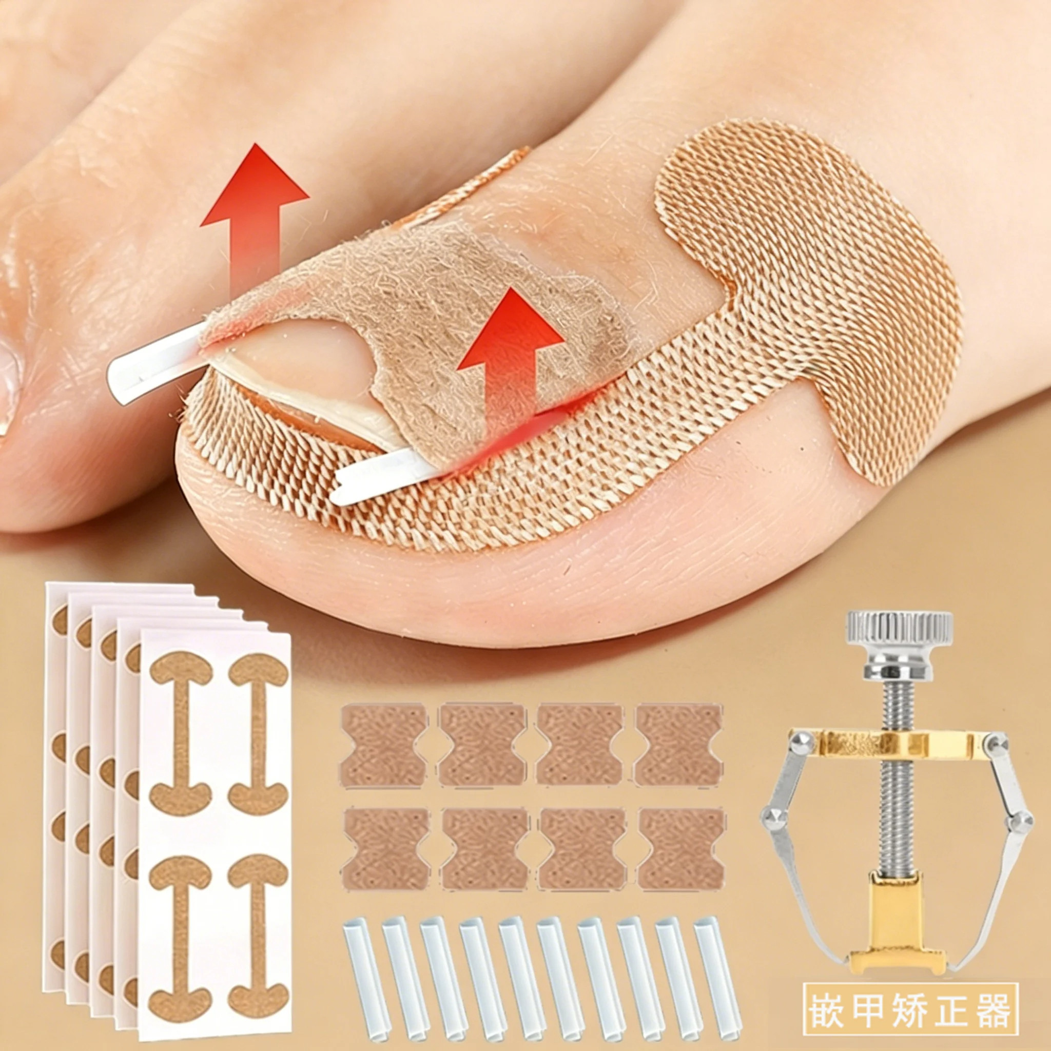 甲沟矫正器指甲嵌甲专用工具正甲贴片炎纠正脚趾甲防长肉隔离垫片