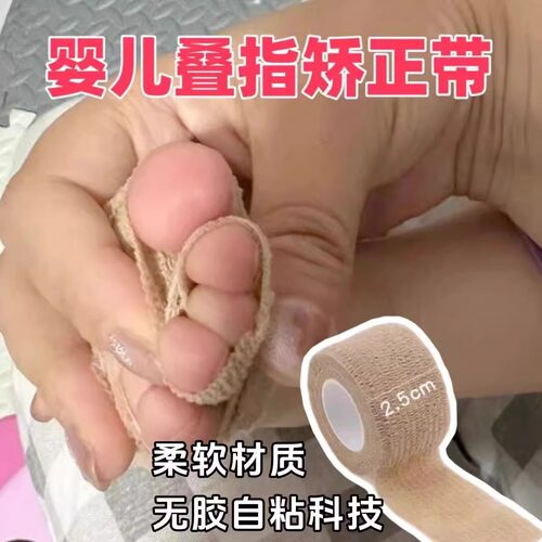 婴儿重叠矫正器儿童脚趾分离器