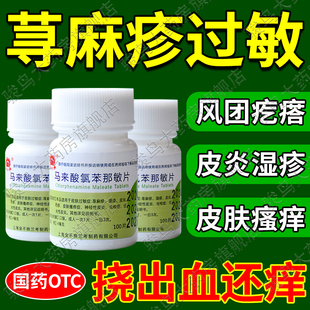 扑尔敏100片治荨麻疹过敏药皮肤瘙痒抗过敏的药马来酸氯苯那敏片