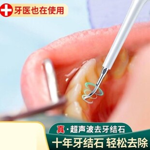 极速掏剔抠牙结石l神器扣牙石清理刮牙垢器清除工具去除器头专业