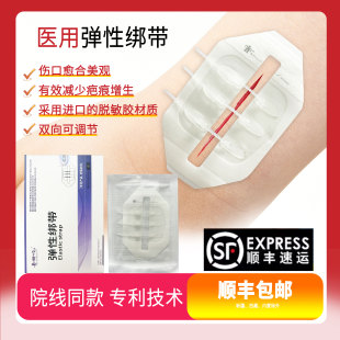 医用皮肤减张贴伤口愈合免缝合剖腹产创口贴疤痕减张器