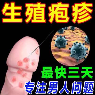 治生殖男器疱疹克星根部防复发外阴囊瘙痒性病一扫光除特效中药膏
