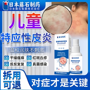 儿童特应性皮炎去止痒根专用喷雾软膏皮肤痒湿疹身体乳药房同售ZR
