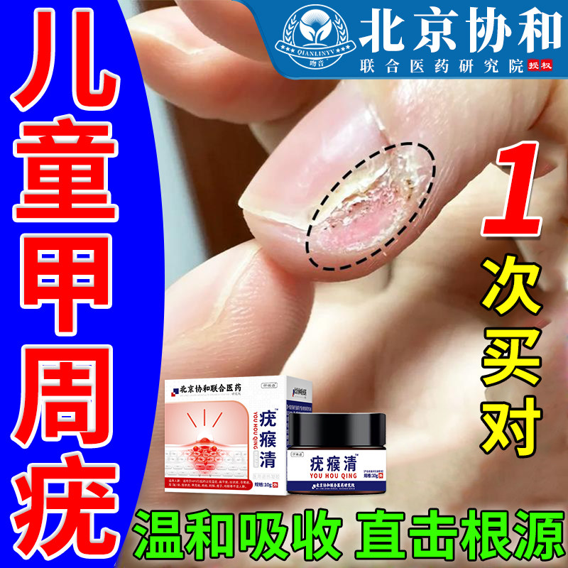 儿童手指甲周疣专用膏手指根甲长疣寻常疣去除神器药房同款zr