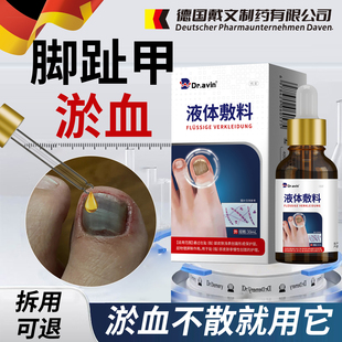 脚趾甲淤血甲沟炎脚趾甲被砸被夹受损瘀血发黑甲床受伤真菌感染HA