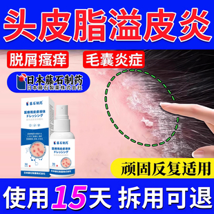 头皮屑脂溢性皮炎喷雾剂真菌感染头癣专用止痒毛囊炎可搭洗发水ZR