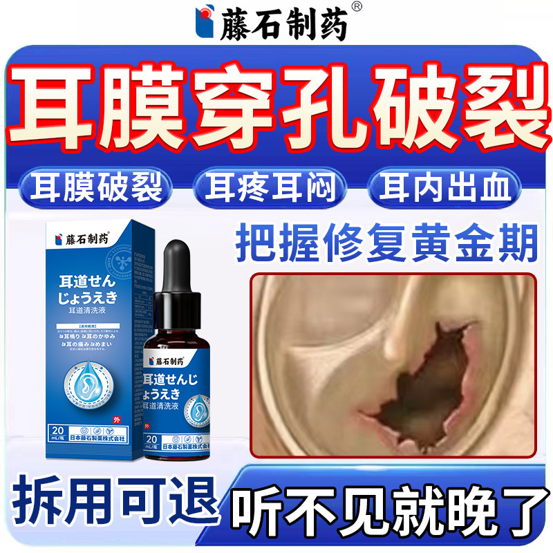 耳膜穿孔修复中耳炎专用可除滴耳液耳朵痒根流脓耳疼耳闷膏药贴ZR