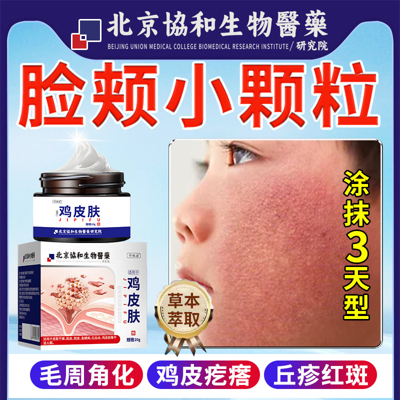 儿童脸部毛周角化症去除鸡皮肤疙瘩毛囊炎角化脸上有小颗粒红斑zr