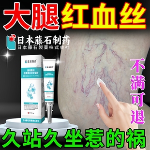 女性腿上有红血丝凝胶静脉曲张去修复毛细血管扩张膏药监备案ZR