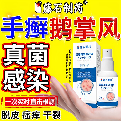 【拆用可退】手癣鹅掌风脱皮干裂