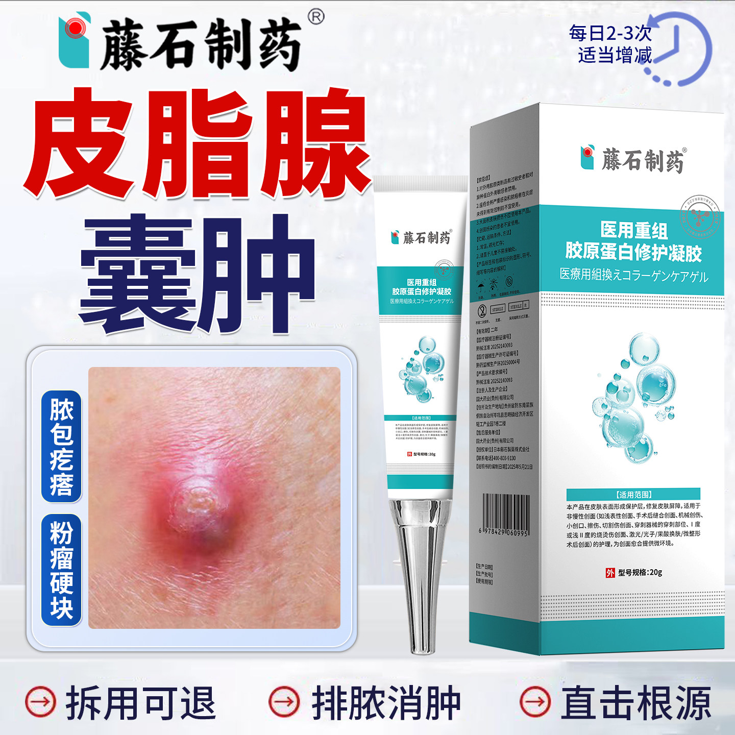 皮脂腺囊肿拔毒专用膏粉瘤粉刺针硬块结节鼓包脓包疖肿药房同售JV