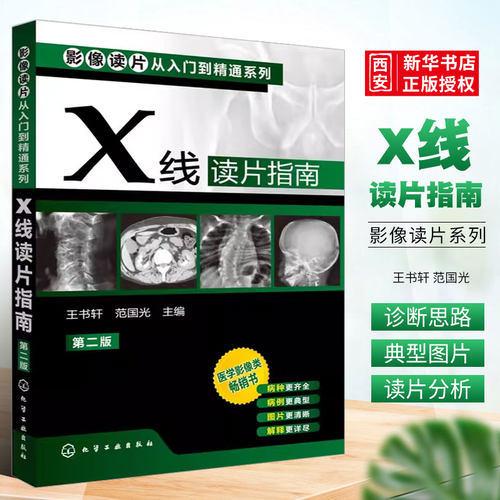 X线读片指南第二版王书轩