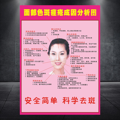 中医美容挂图面部色斑与座疮产生的原因医院布置装饰贴画海报1738