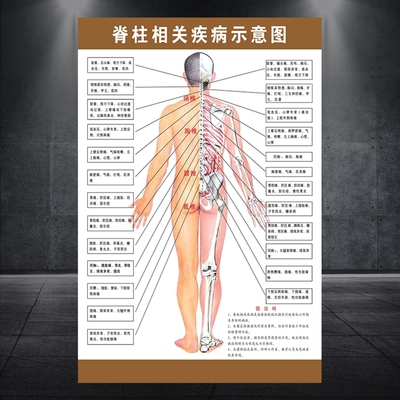 脊柱相关疾病示意图中医养生病理原因结构图挂图海报661