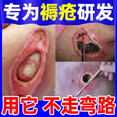 褥疮膏生压疮肌专用贴膏外用老人烂腿去臀部抑菌腐卧床瘫痪防垫
