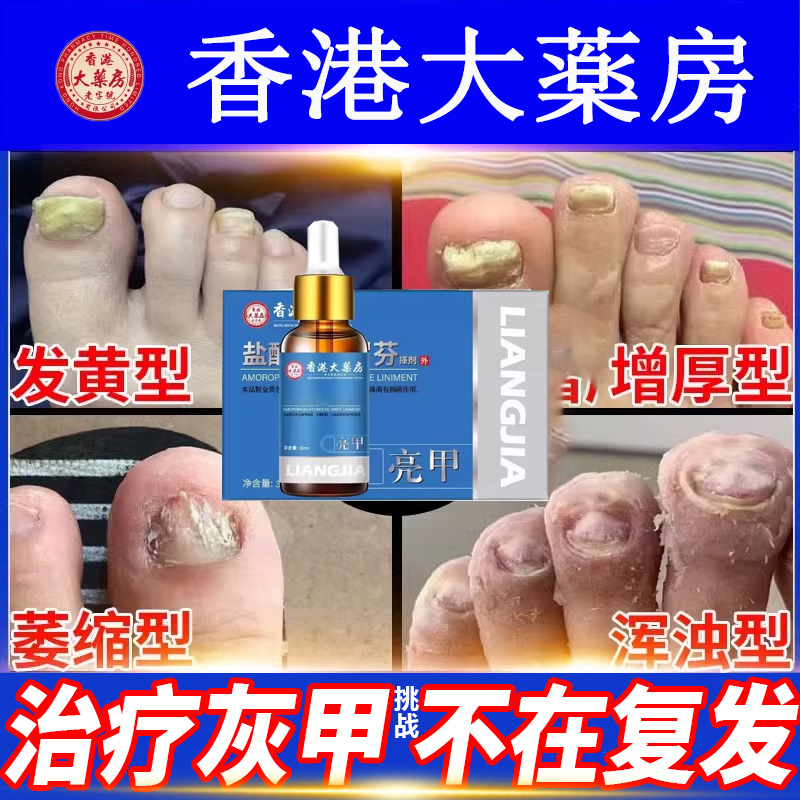 阿莫罗芬搽剂灰指甲正品官方旗舰店修复抑菌液盐酸真菌感染脱甲膏