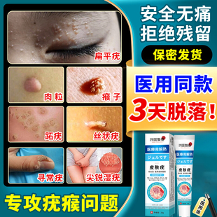 扁平疣软膏丝状寻常跖疣尤瘊小肉粒瘊子非神器去专除用一抹灵药膏