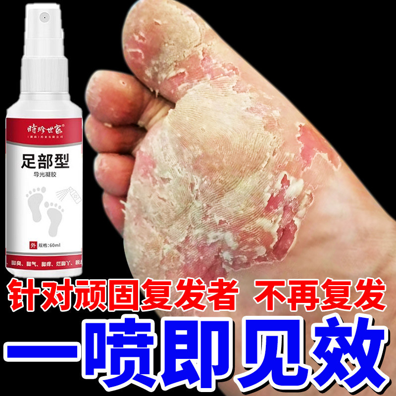 时珍世家足部型凝胶汗脚臭脚气脚痒脱皮烂脚丫喷雾剂一次净抑菌液