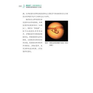 性病防治科普知识100问 正版书籍 新华书店旗舰店文轩官网 四川科学技术出版社