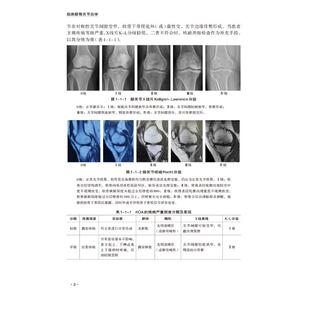 临床膝骨关节炎学