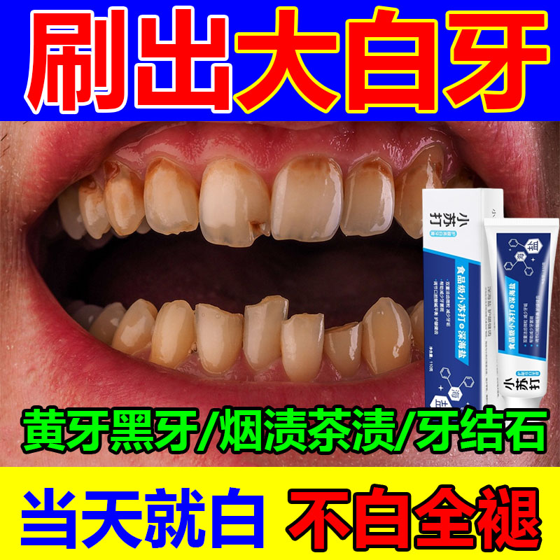 【一刷白】小苏打专用牙膏