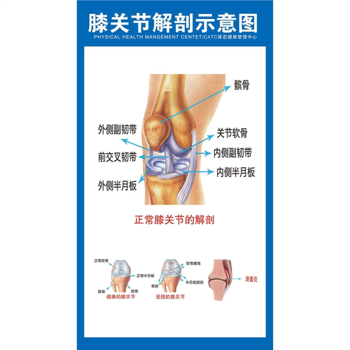 定制图肌筋膜链与激痛点原发痛传导痛意大利FM筋膜手法神经卡压图