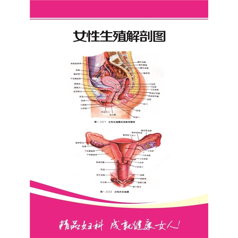 女性生殖解剖图海报展板女性泌尿生殖系统解剖图宫颈疾病参考图