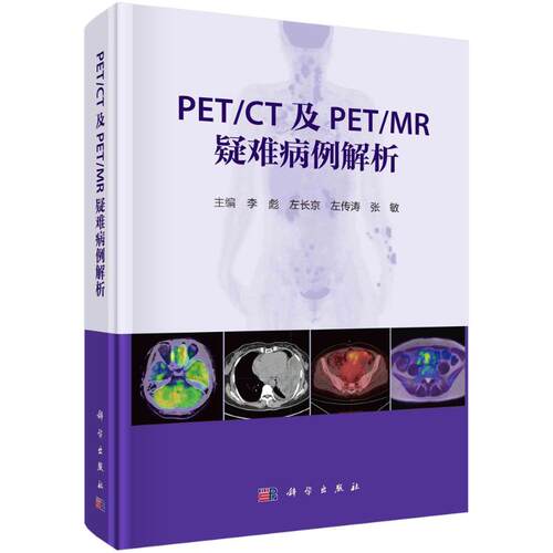 PET/CT及PET/MR疑难病例解析李彪科学出版社9787030781062