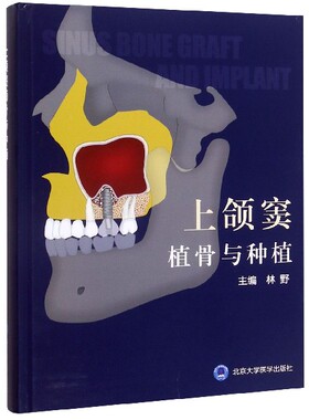 上颌窦植骨与种植(精)编者:林野|责编:王智敏北京大学医学9787565921575