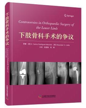 下肢骨科手术的争议(西)E. Carlos Rodriguez-Merchan，(英)Alexander D. Liddle原著中国科学技术出版社9787523605011