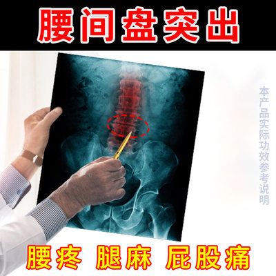 腰间盘腰疼腿疼屁股疼药房同售