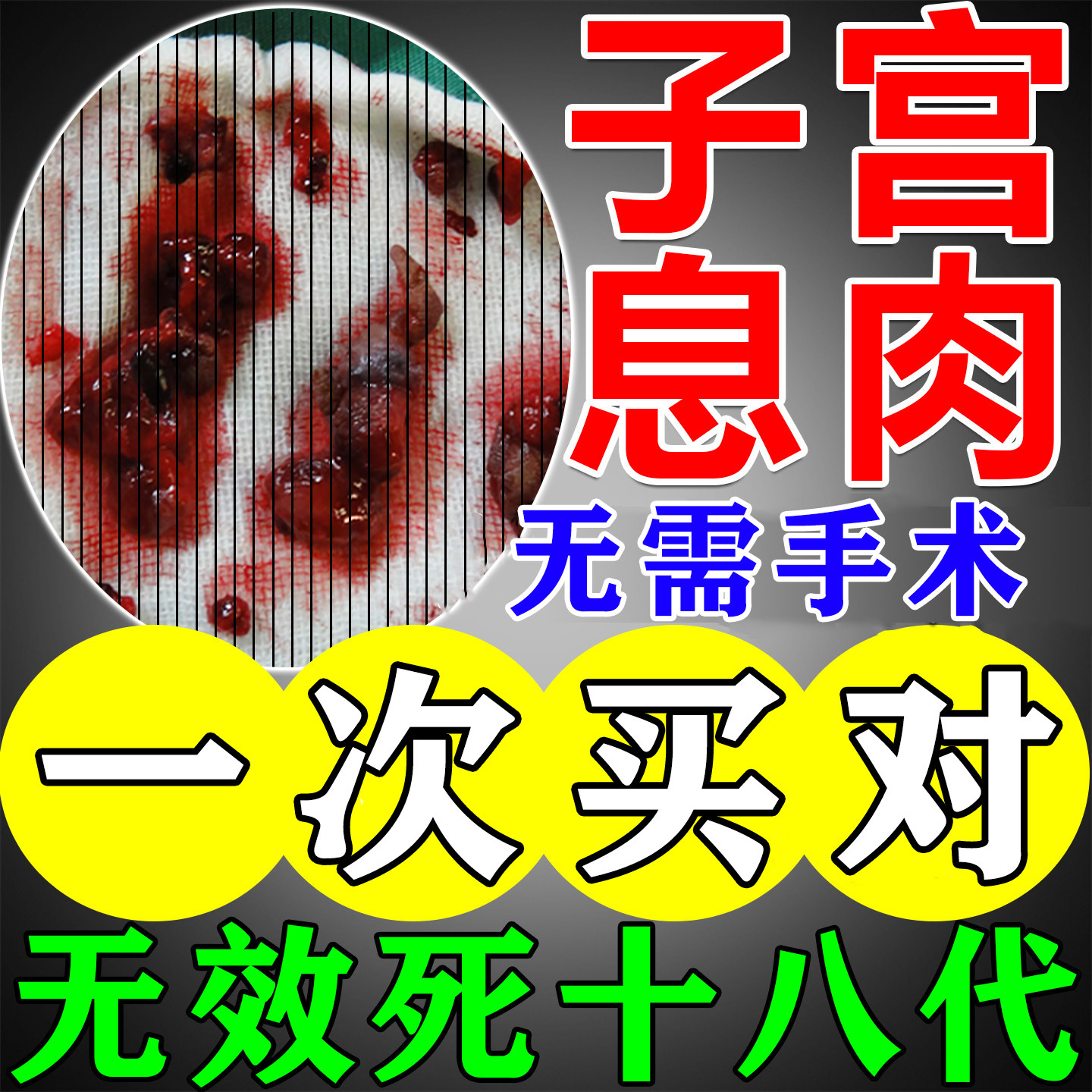 治疗子宫内膜息肉中非药贴肌瘤卵巢囊肿增厚热敷包下垂异位症调理
