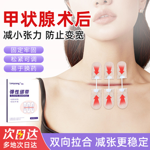 隆畅医用拉链式减张器甲状腺术后伤口愈合儿童疤痕免缝合减张贴