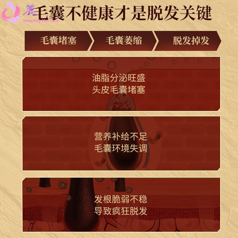 特一防脱清爽洗发水防脱固发洗发露控油蓬松防掉发柔顺洗头水露膏