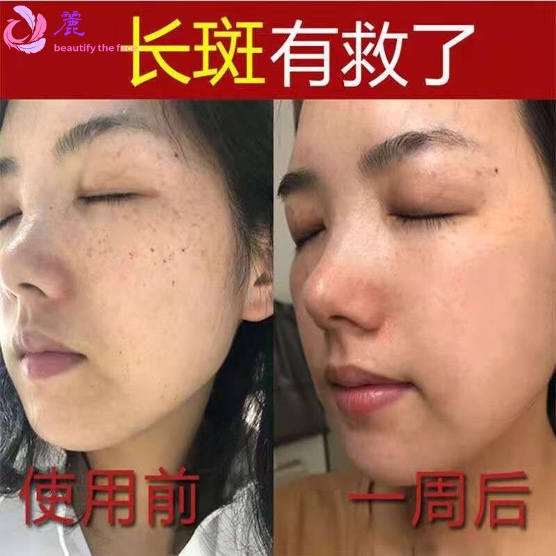 草本祛斑黄芪霜美白祛黄改善暗沉日霜晚霜修护霜美容院线
