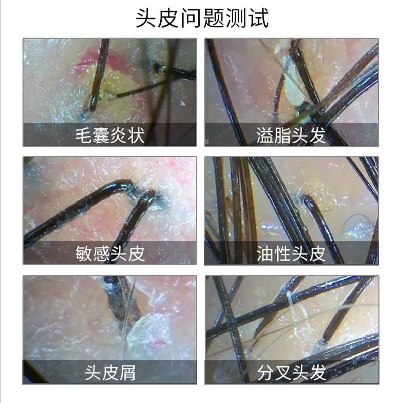极速头皮检测仪毛囊头发测试仪器理发店高清放大器一体机专用分析